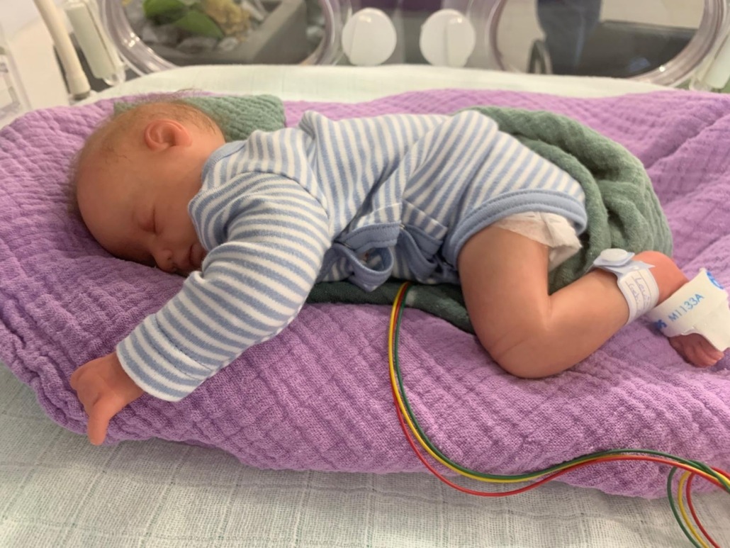 Ein schlafendes Baby in blau-weißem Strampler liegt auf lila Decke, mit Monitor-Kabeln am Fuß.