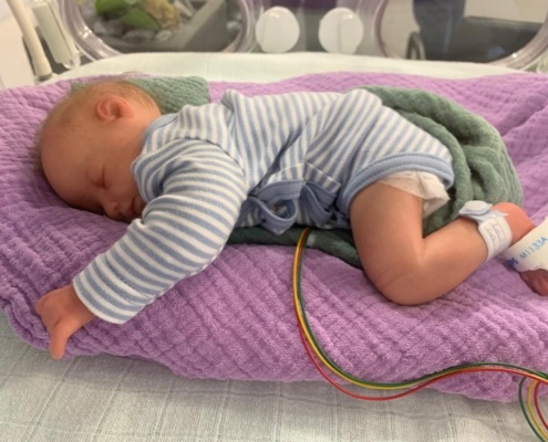 Ein schlafendes Baby in blau-weißem Strampler liegt auf lila Decke, mit Monitor-Kabeln am Fuß.